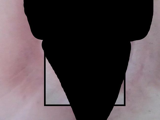 vi*rostab und behaart