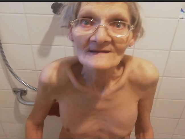 Anpin**ln über kit**** und musc**