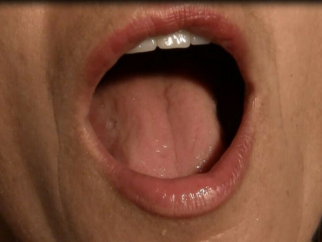 Für Peter, Mundfo**e