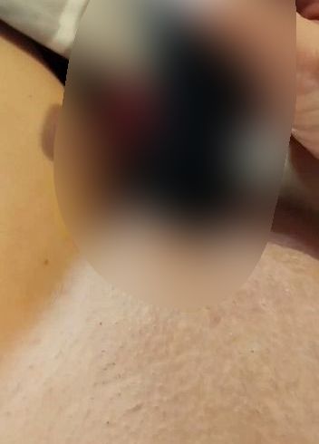 Ein Zusammenschnitt, der unter die Haut geht......