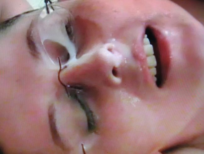 AUF DIE BRILLE GEspri**T